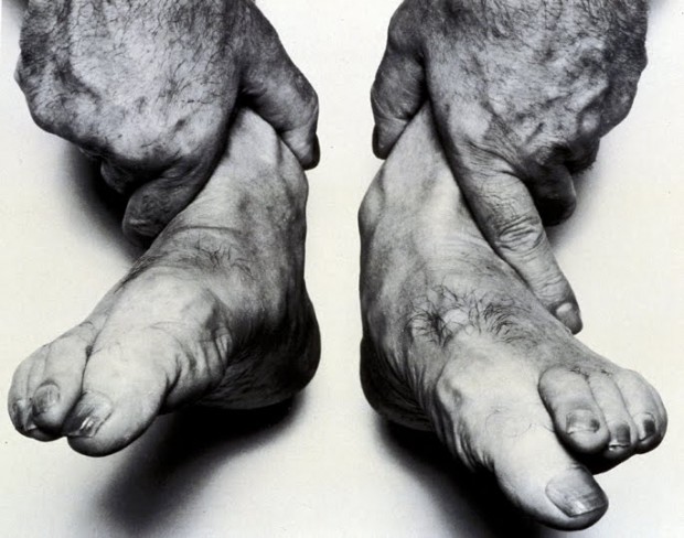 John Coplans. Auto-retrato, 1985