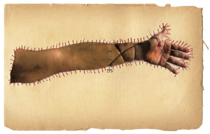 Sobremarinhos_braco_001